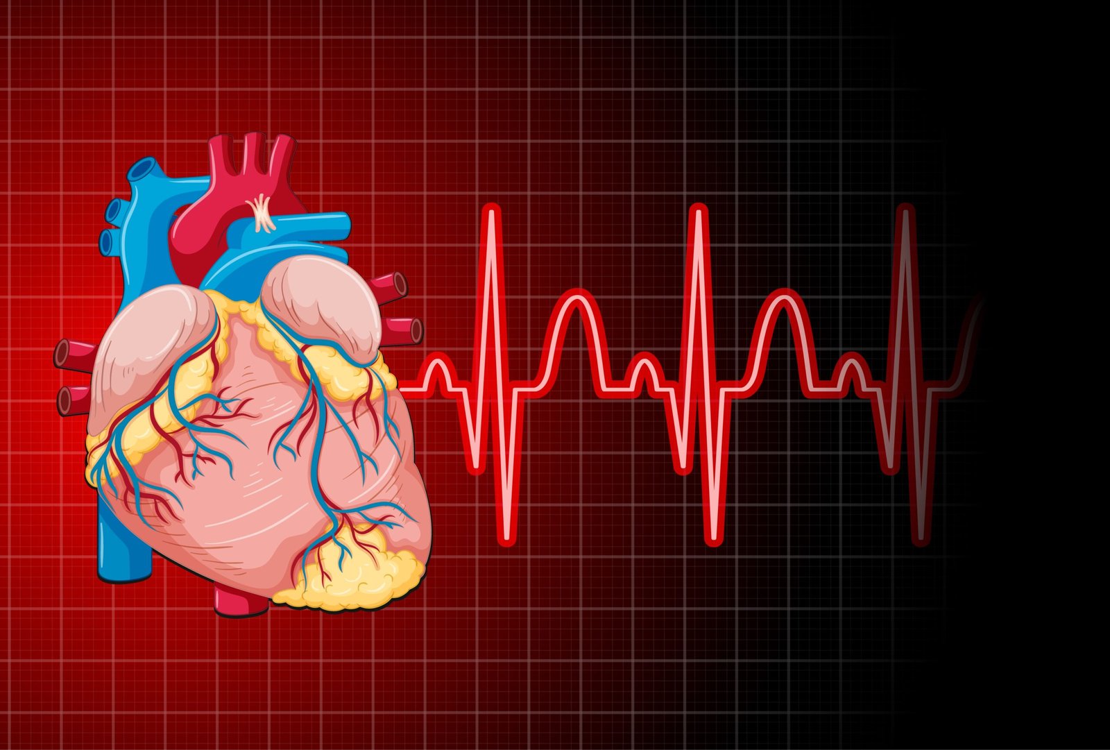 Complicaciones de la aterosclerosis: ¿Qué son y cómo se relacionan con la enfermedad cardiovascular? soluciones inteligentes solucionint